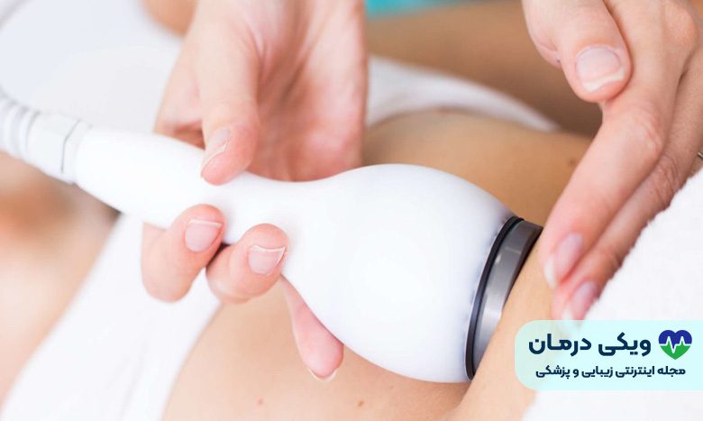 عوارض کویتیشن