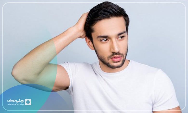 کاشت مو به روش FCI چیست و چگونه صورت میگیرد؟