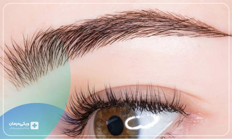 کاشت ابرو طبیعی و دائمی
