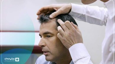 بهترین روش های درمان ریزش مو