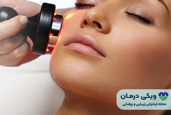 لایه برداری با لیزر