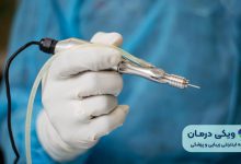 بهترین دکتر ریزش مو