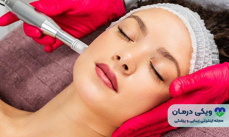 فیشیال میکرونیدلینگ (Microneedling)