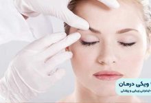 عمل بلفاروپلاستی