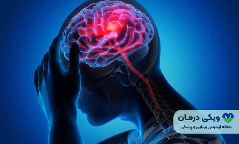 پیشگیری از سکته مغزی