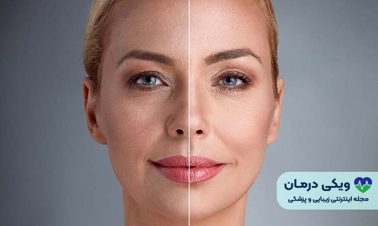 جوانسازی پوست با شست و شوی صورت
