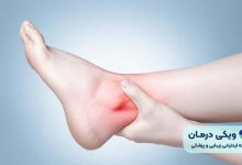 پیچ خوردن مچ پا