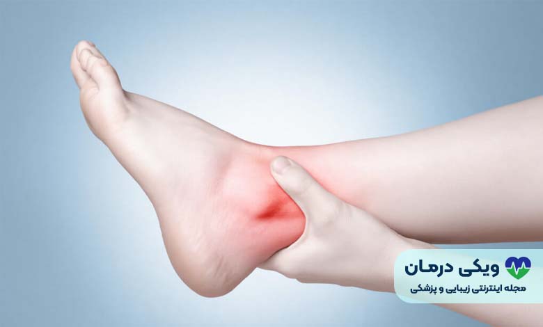 پیچ خوردن مچ پا