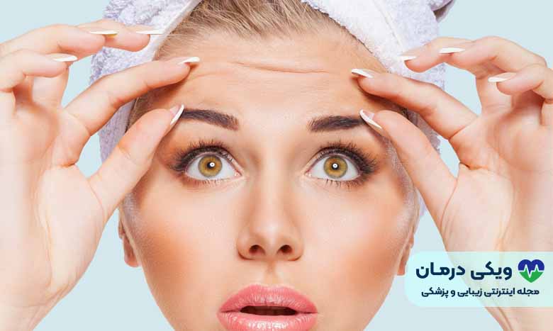 مراقبت های بعد از بوتاکس