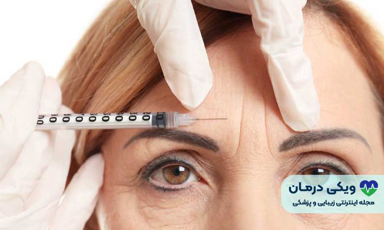 آیا می توان اثر بوتاکس را از بین برد؟