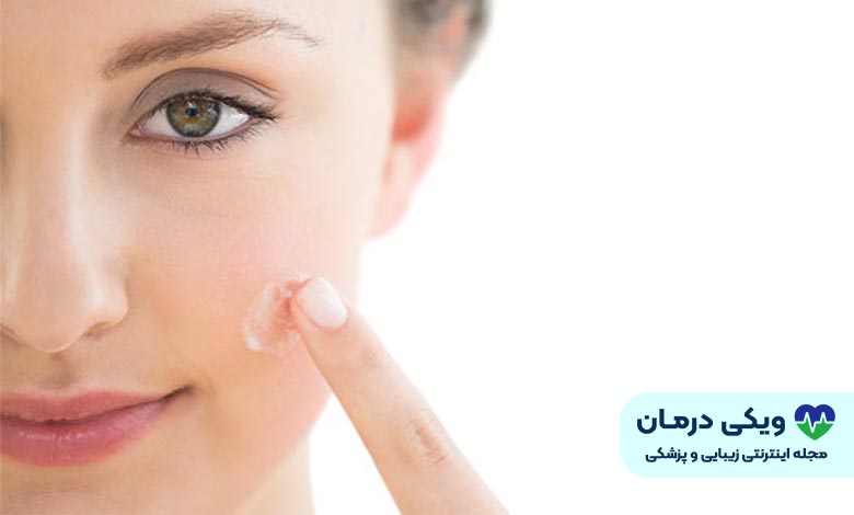 بهترین کرم برای جوش صورت