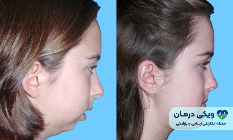 بهترین جراح فک و صورت