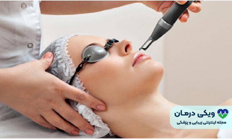 فیشیال لایه‌برداری با لیزر (Laser Resurfacing)