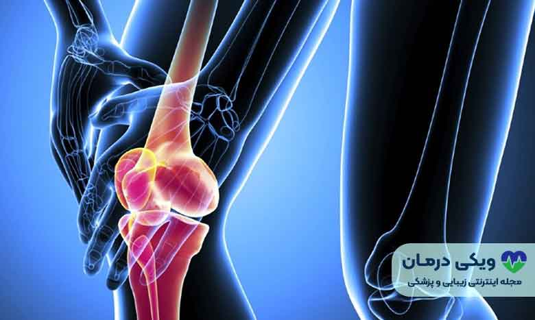 علائم پوکی استخوان