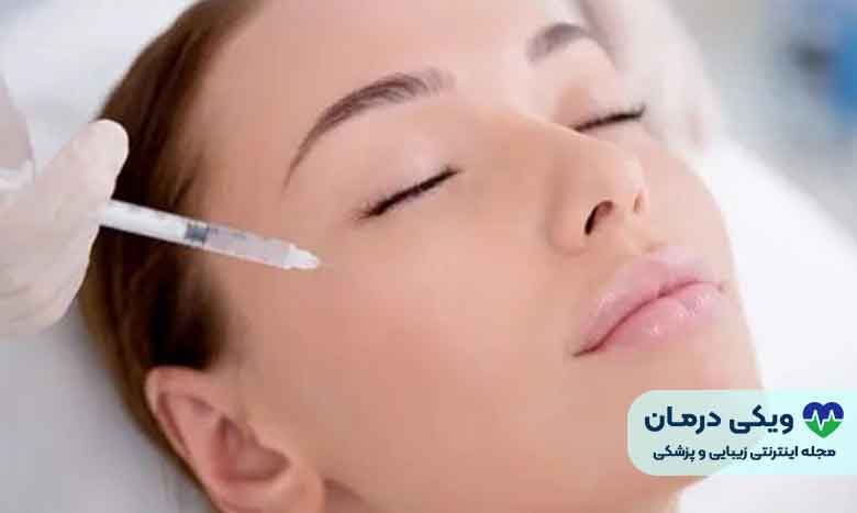هزینه تزریق ژل گونه