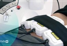 پیکرتراشی با لیزر قیمت