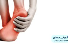 درمان خار پاشنه