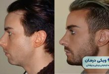 بهترین جراح فک و صورت در ایران