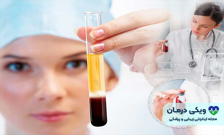 پی آر پی