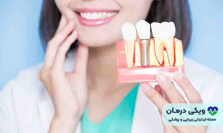 معایب روکش زیرکونیوم دندان