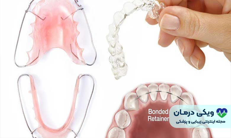 براکت دندان