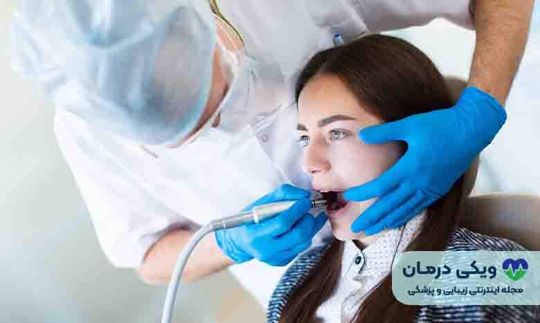 هزینه کشیدن دندان آسیاب