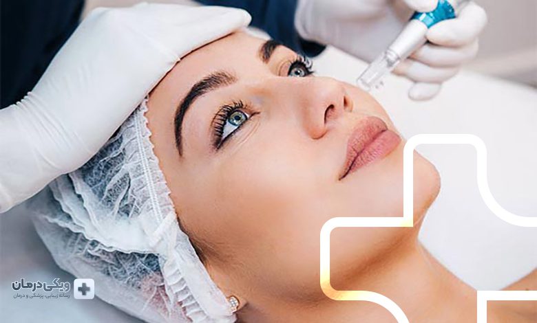 بهترین کلینیک مزونیدلینگ