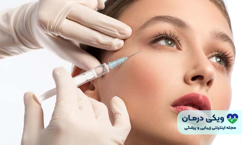انواع ژل آلیاکسین