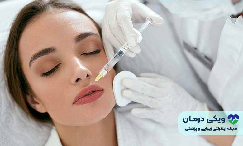 بوتاکس لب چیست؟