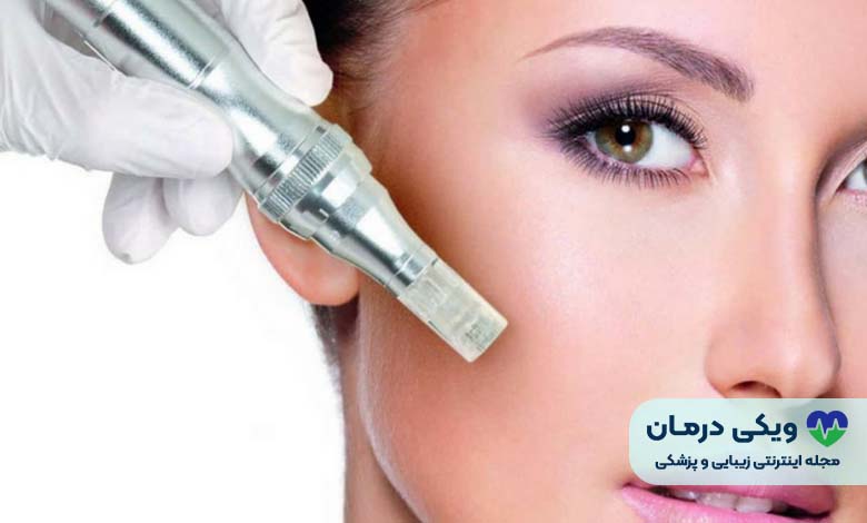 قیمت مزونیدلینگ