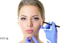 بهترین دکتر تزریق ژل