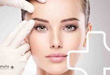 بهترین دکتر زاویه سازی صورت
