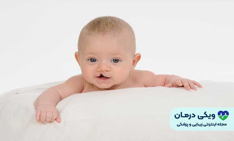 لب شکری