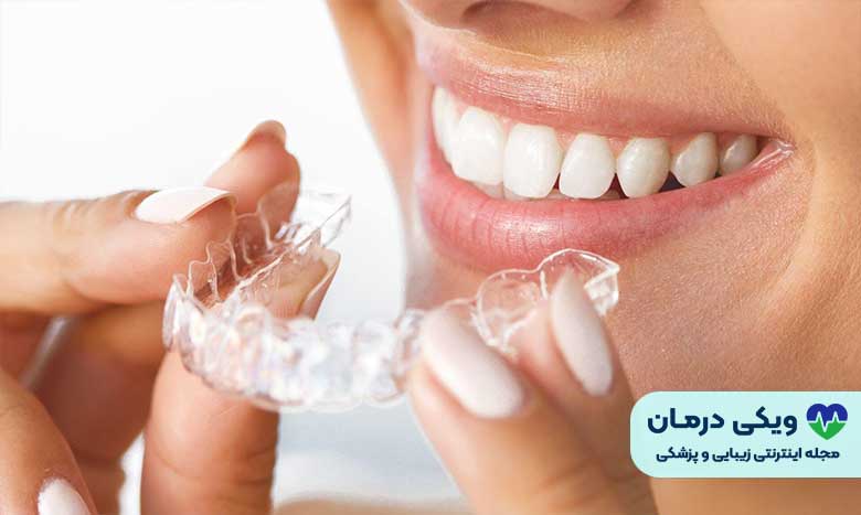 نگهدارنده شفاف
