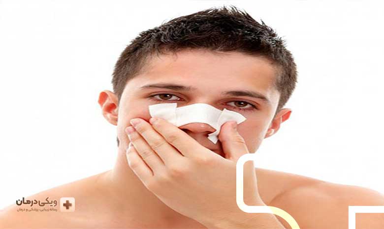 خطرات جراحی زیبایی بینی