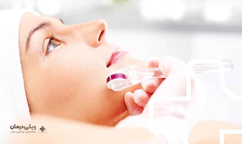 قبل از میکرونیدلینگ چه کارهایی انجام دهیم؟