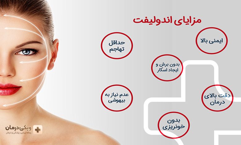 مزایای اندولیفت