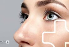 بهترین کلینیک جراحی بینی