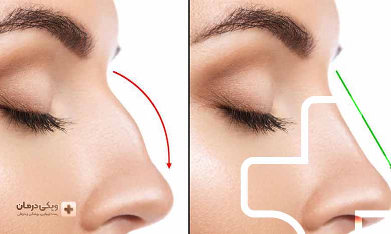 ویژگی های کلینیک جراحی بینی