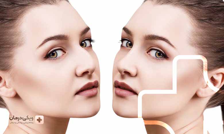 کلینیک جراحی بینی چیست؟