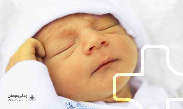 چه زمان زردی نوزاد خطرناک است