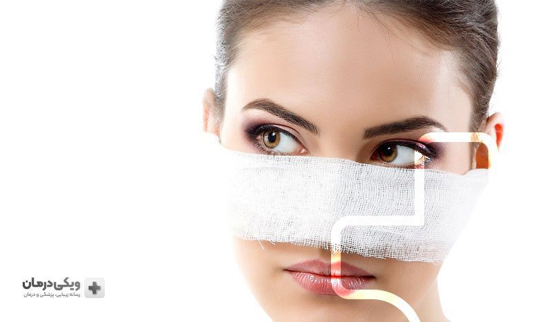 نحوه عمل زیبایی بینی