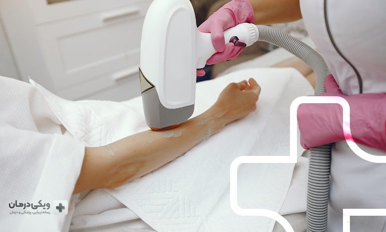 بهترین مرکز لیزر مو شریعتی