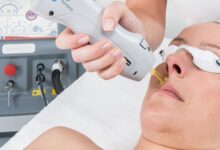 لیزر موی جردن