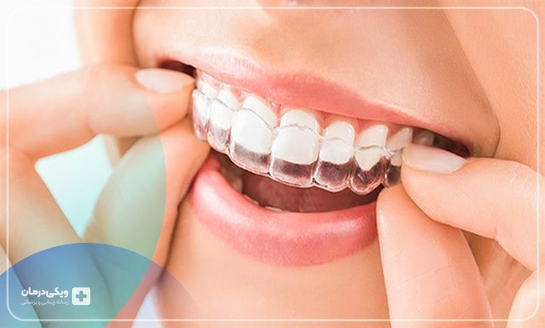 نایت گارد چیست؟