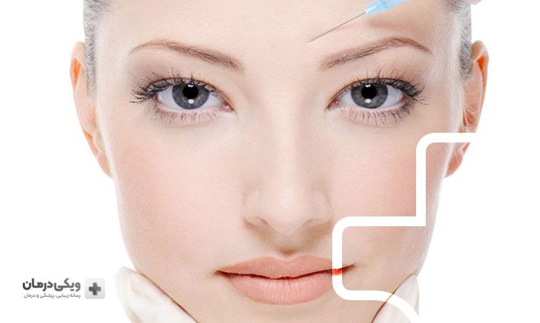 محدودیت های بوتاکس