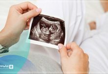 سونوگرافی 3 بعدی