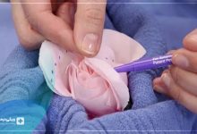 عمل زیبایی واژن