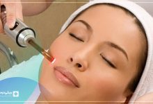 لیزر مو جنوب تهران