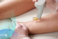 لیزر مو شهرک غرب